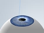 visumax_011