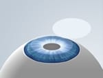 visumax_021