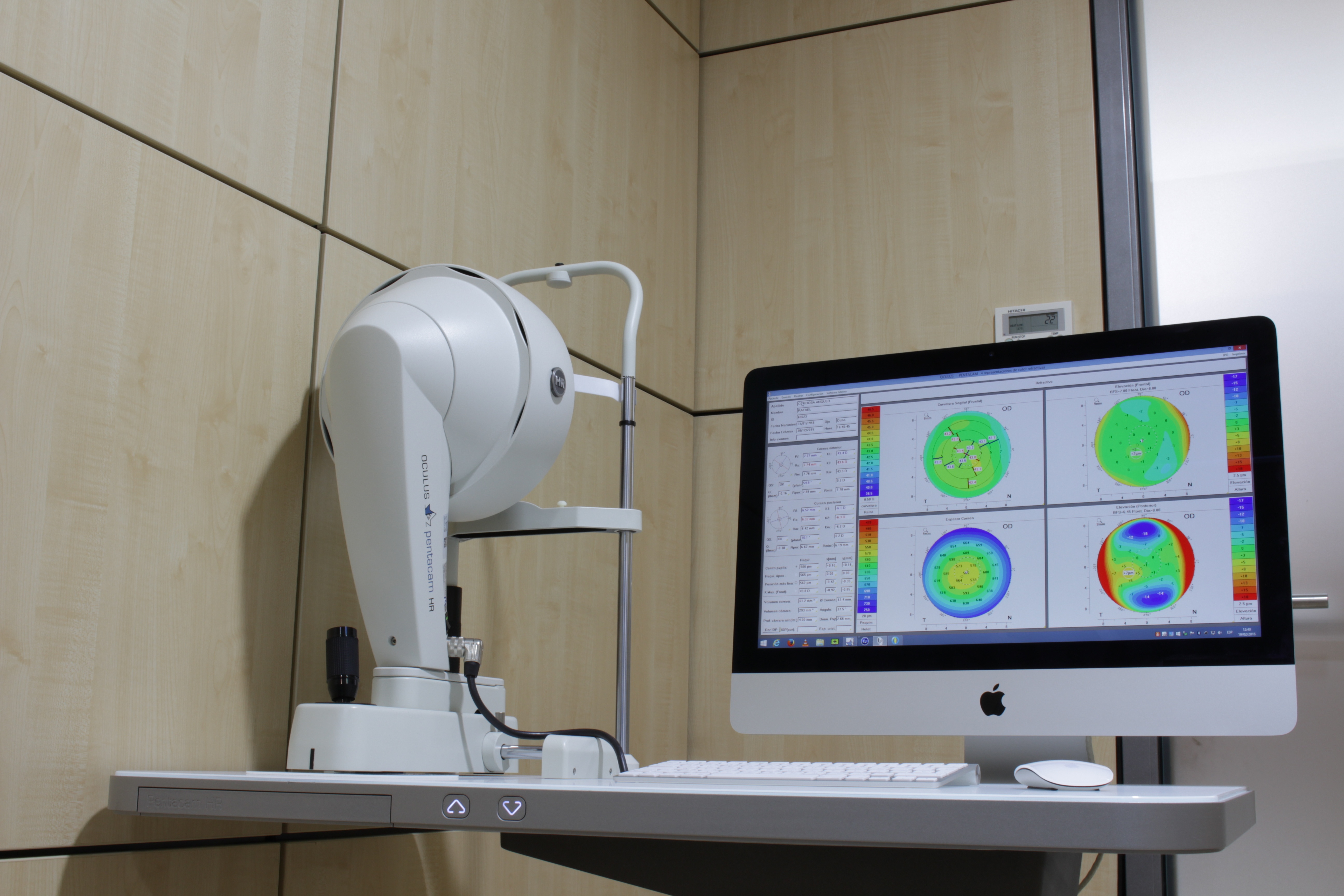 Pentacam: un nuevo aliado para tu salud ocular