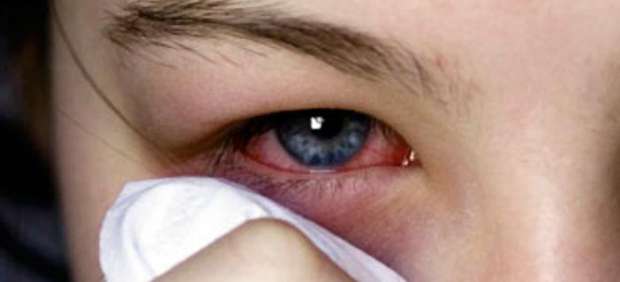Reduce las molestias del ojo lloroso