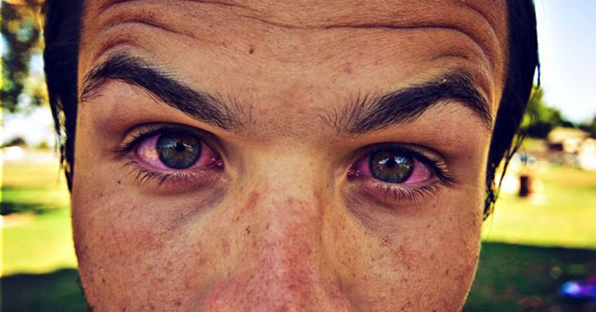 Ojos Rojos