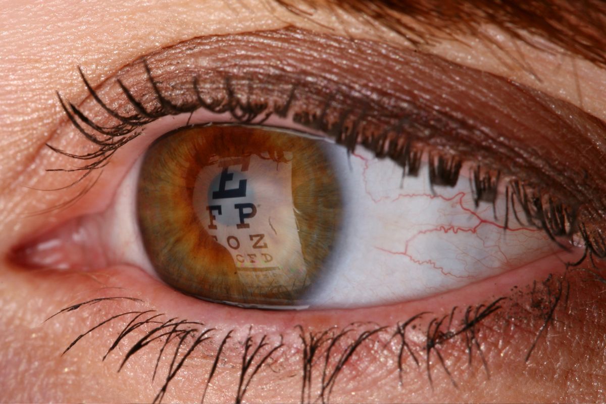 Consejos para postoperatorio de desprendimiento de retina